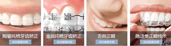 矫正牙齿